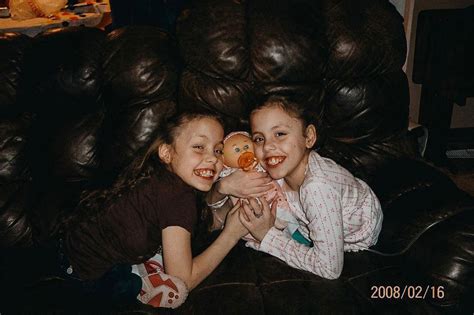 gabby garcia conjoined twin|I Lost My Sister at 13 with Oneleggabby 